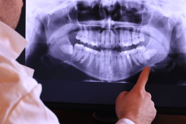Best Emergency Broken Tooth Repair in Wickenburg, AZ